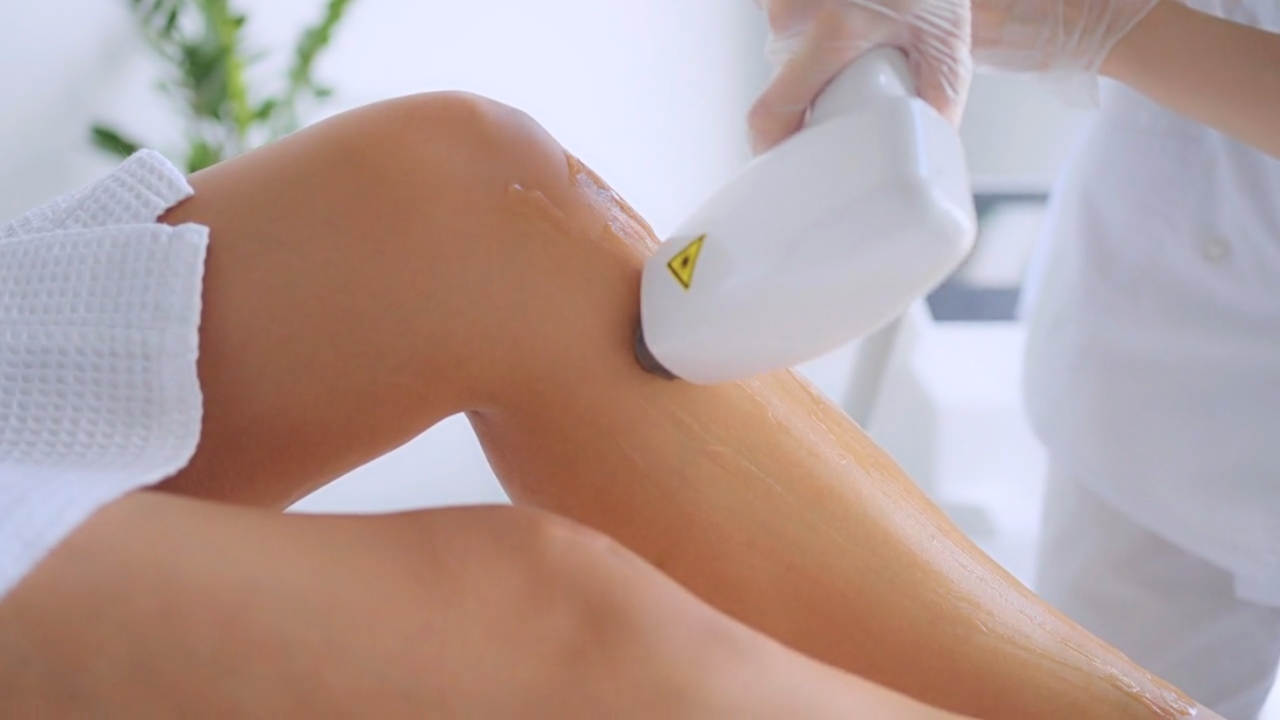 Laserontharing met NovaLaser